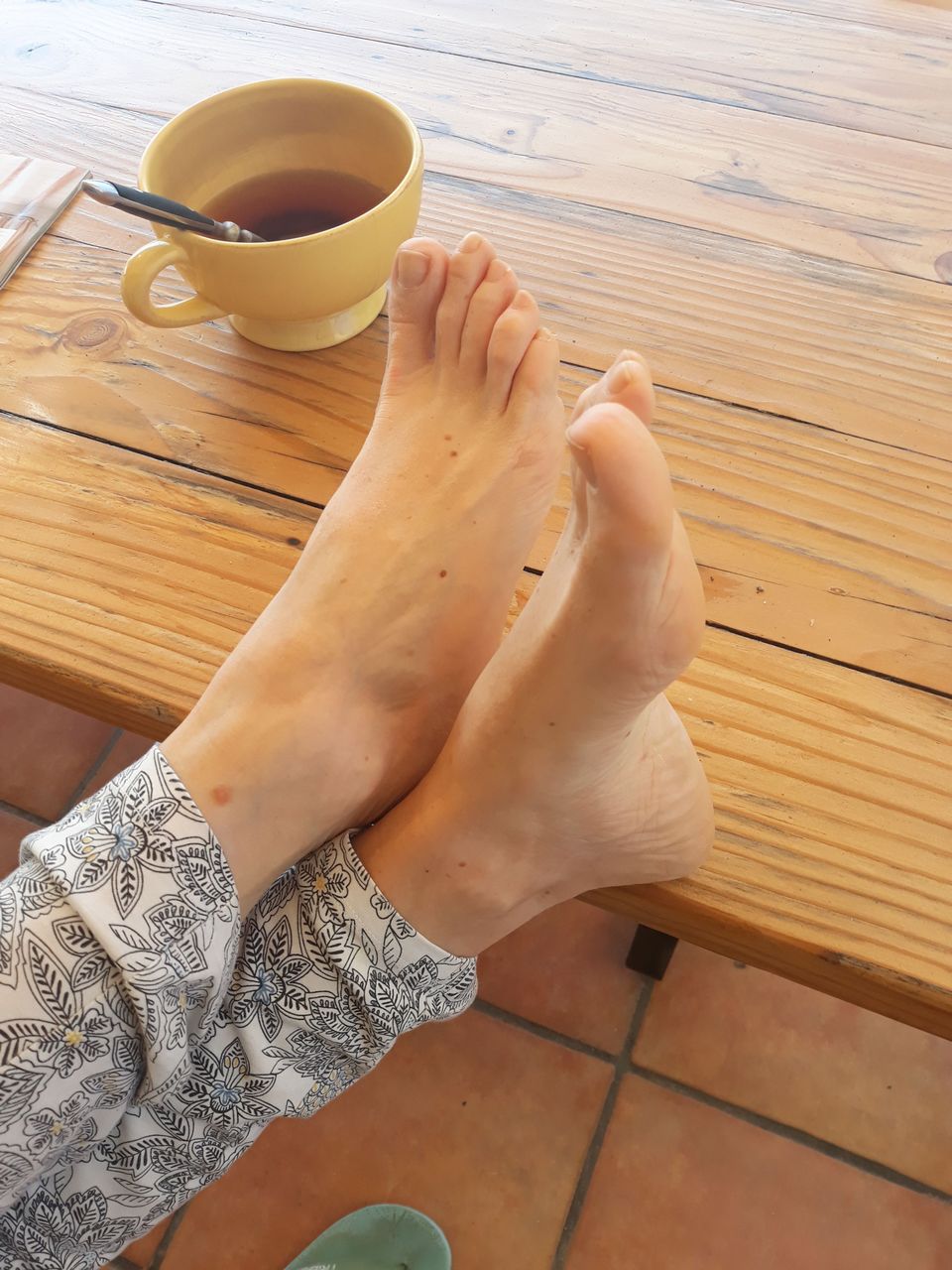 Alsfeet31 Il Fait Beau Aujourd Hui