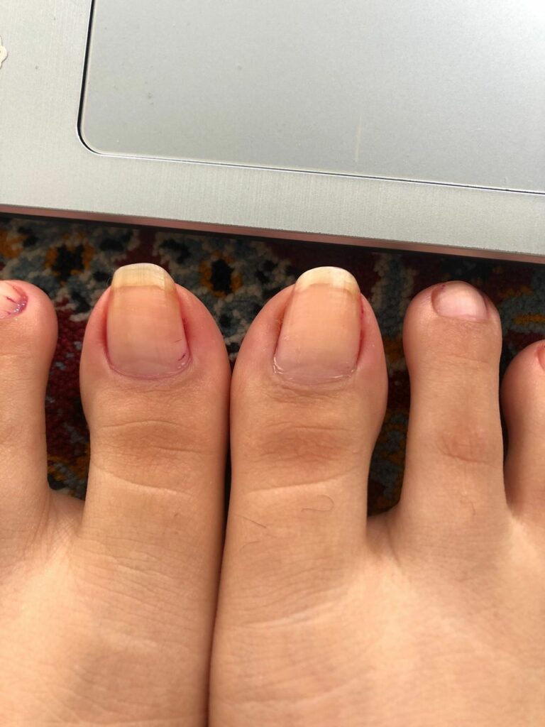 Miki Feet Nails (5 photos)
