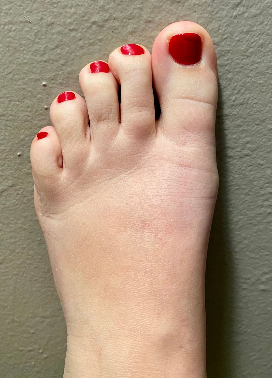 Yourwhiterabbit Trying Poses