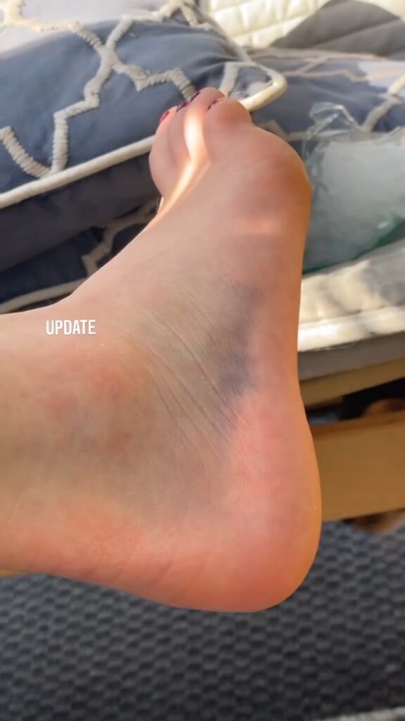 Sophie N Lisse Feet (2 images)