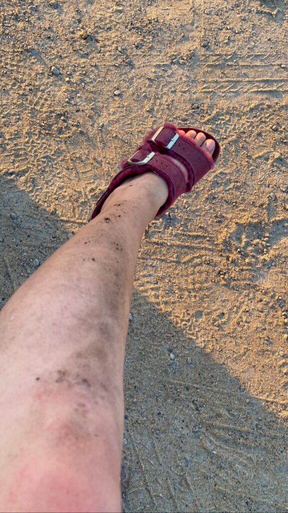 Deligracy Feet (3 pictures)
