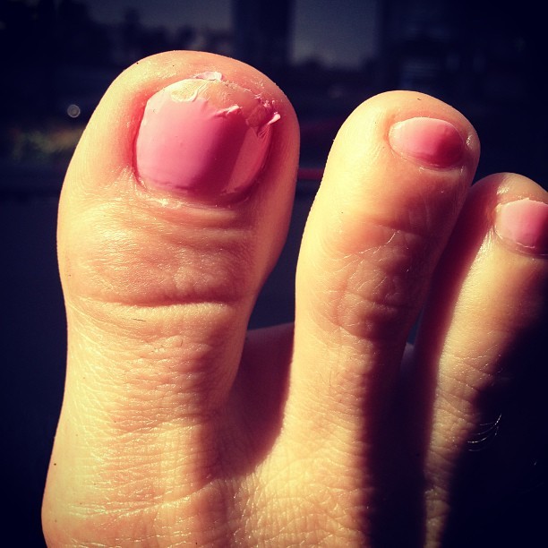 Schell M Peterson Feet